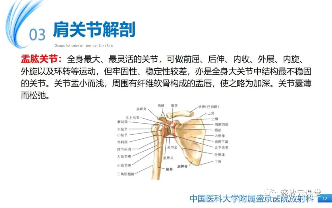 影像PPT - 【PPT】肩关节周围炎(肩周炎)-12