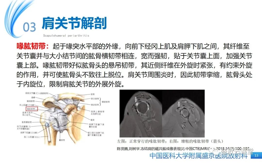 影像PPT - 【PPT】肩关节周围炎(肩周炎)-13