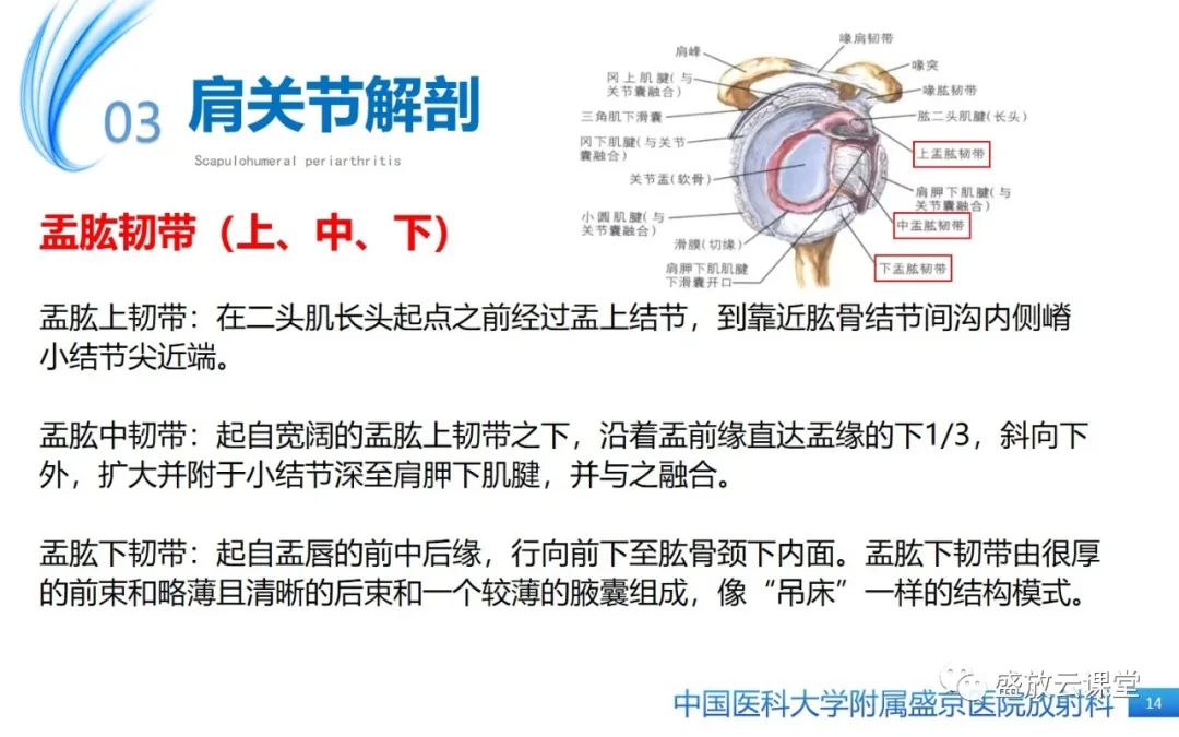 影像PPT - 【PPT】肩关节周围炎(肩周炎)-14