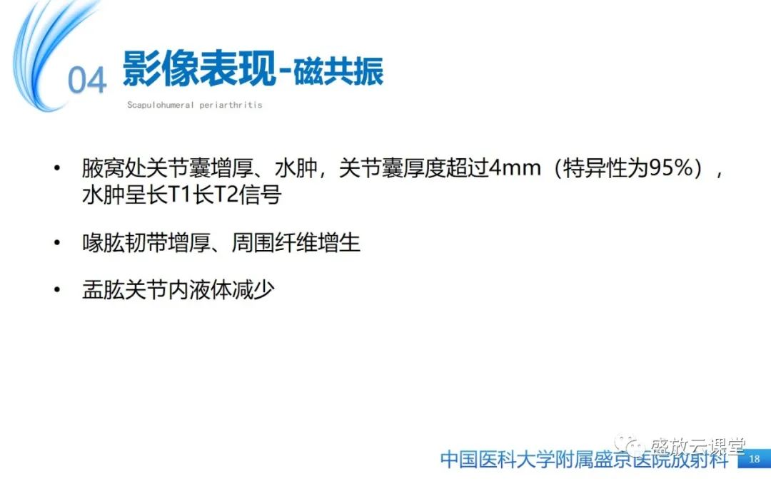 影像PPT - 【PPT】肩关节周围炎(肩周炎)-18