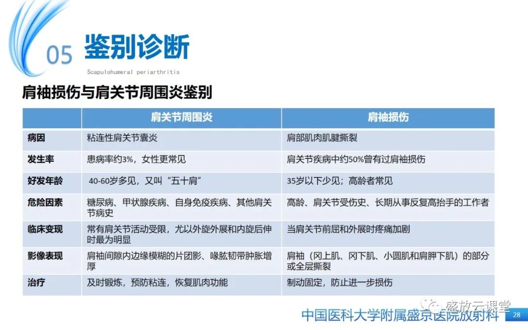 影像PPT - 【PPT】肩关节周围炎(肩周炎)-28