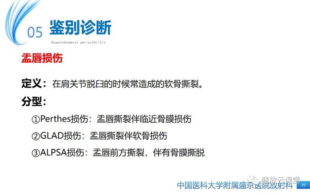 影像PPT - 【PPT】肩关节周围炎(肩周炎)-29