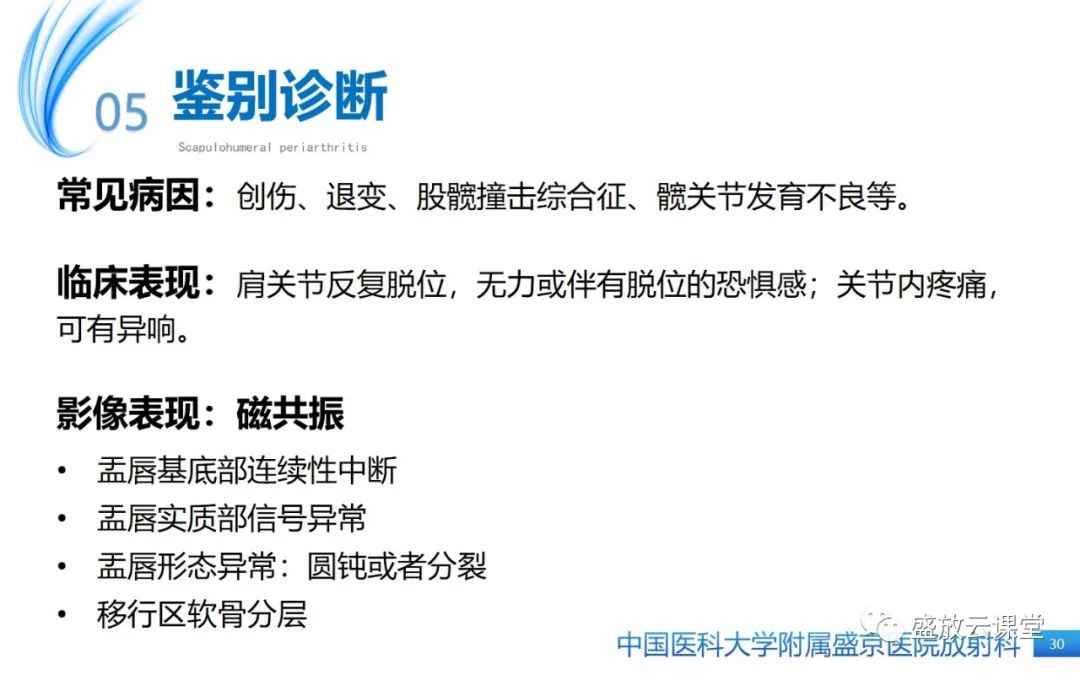影像PPT - 【PPT】肩关节周围炎(肩周炎)-30