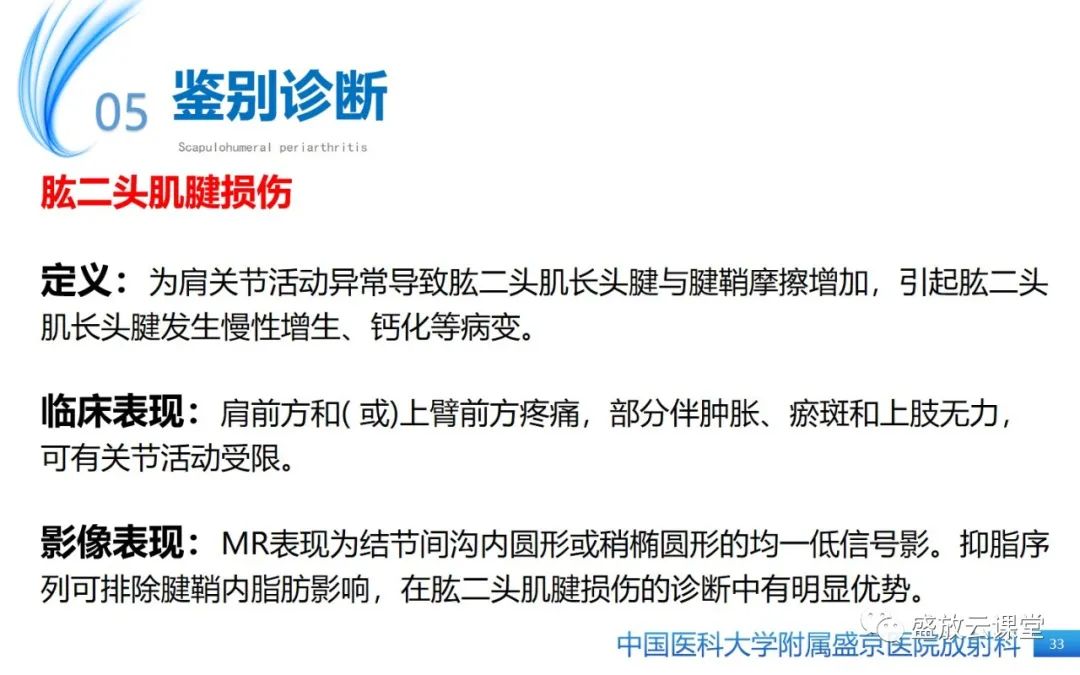 影像PPT - 【PPT】肩关节周围炎(肩周炎)-33