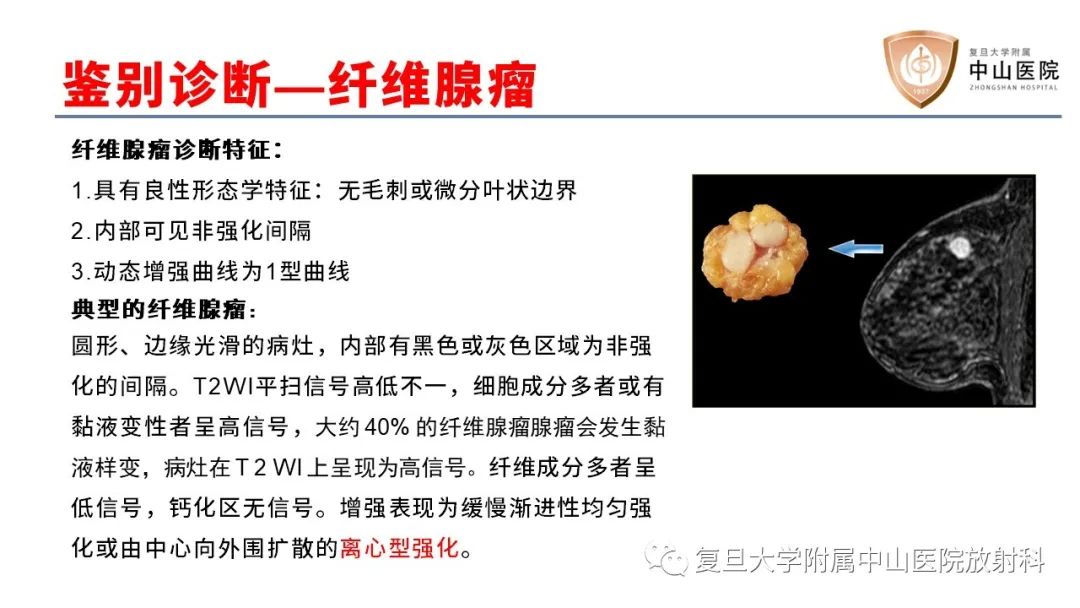 影像PPT - 【病例】乳腺粘液腺癌1例MR影像-21