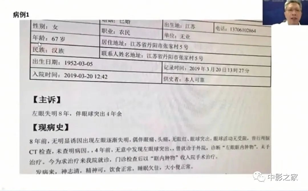 影像PPT - 【PPT】眶颅沟通性病变影像诊断-11