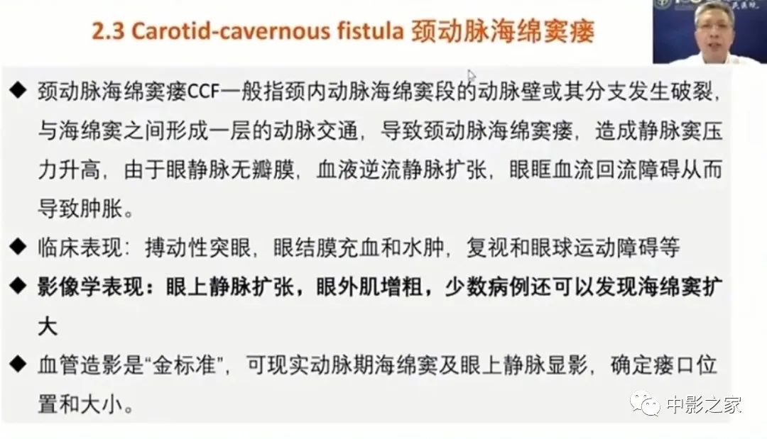 影像PPT - 【PPT】眶颅沟通性病变影像诊断-31