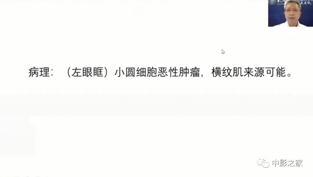 影像PPT - 【PPT】眶颅沟通性病变影像诊断-41