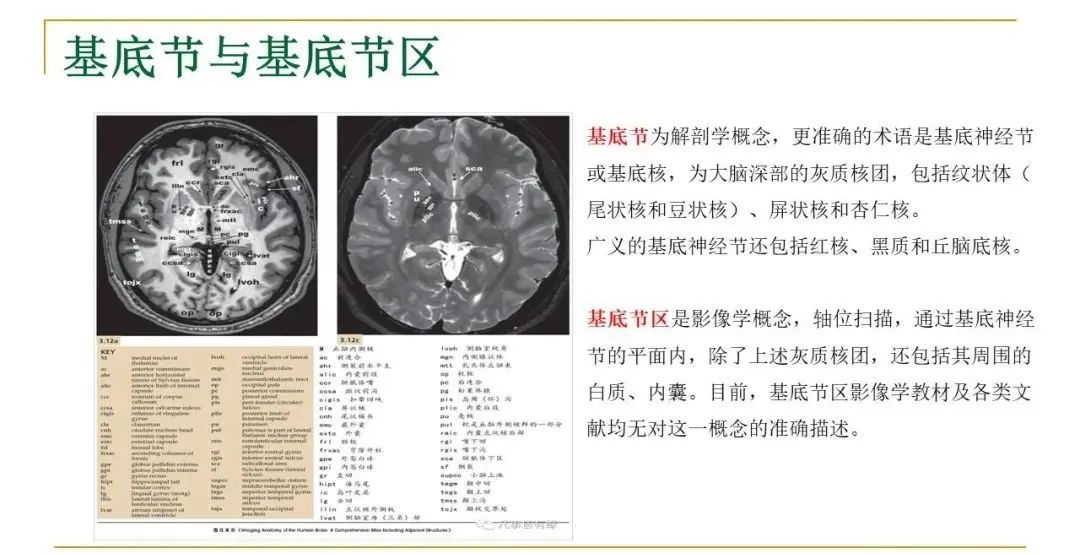 影像PPT - 【PPT】影像报告注意事项汇总(神经系统)-2