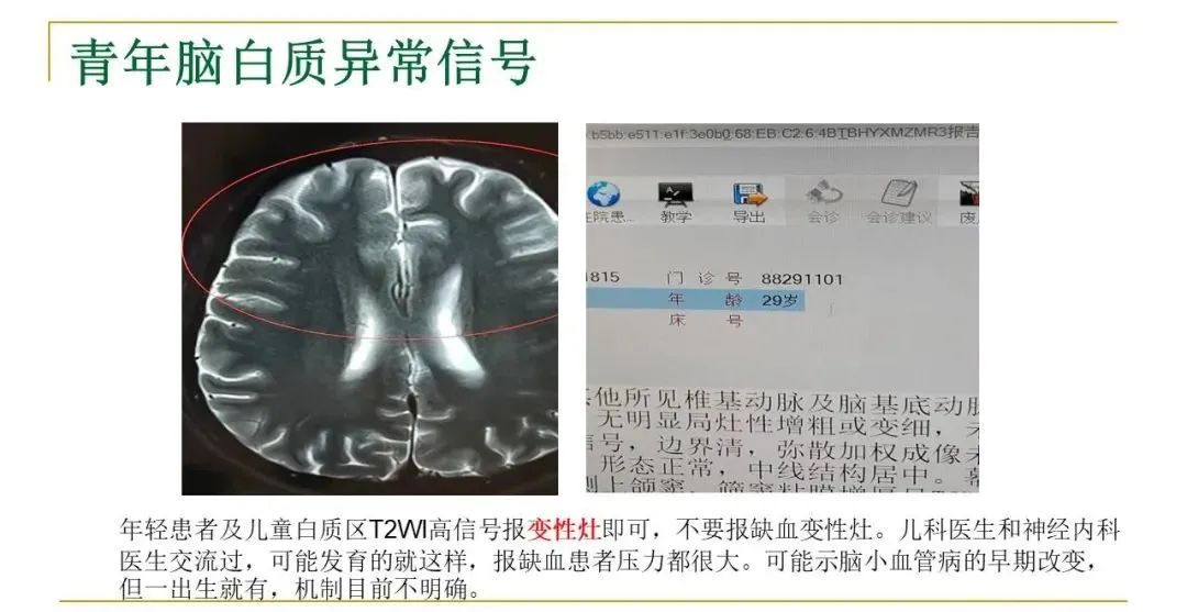 影像PPT - 【PPT】影像报告注意事项汇总(神经系统)-14