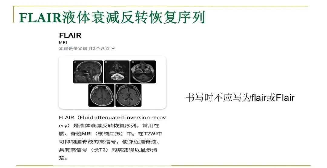 影像PPT - 【PPT】影像报告注意事项汇总(神经系统)-15