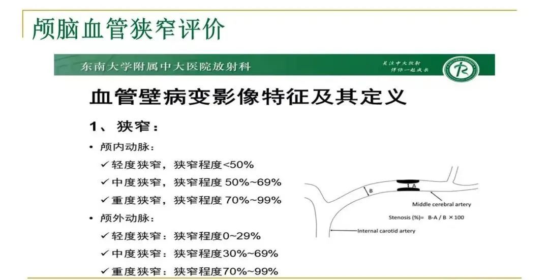 影像PPT - 【PPT】影像报告注意事项汇总(神经系统)-22