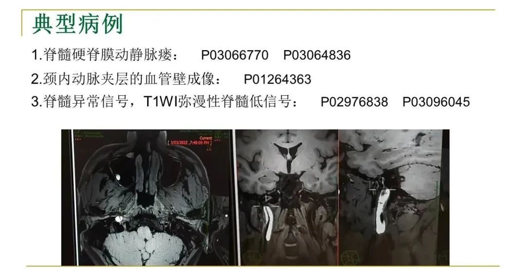 影像PPT - 【PPT】影像报告注意事项汇总(神经系统)-27