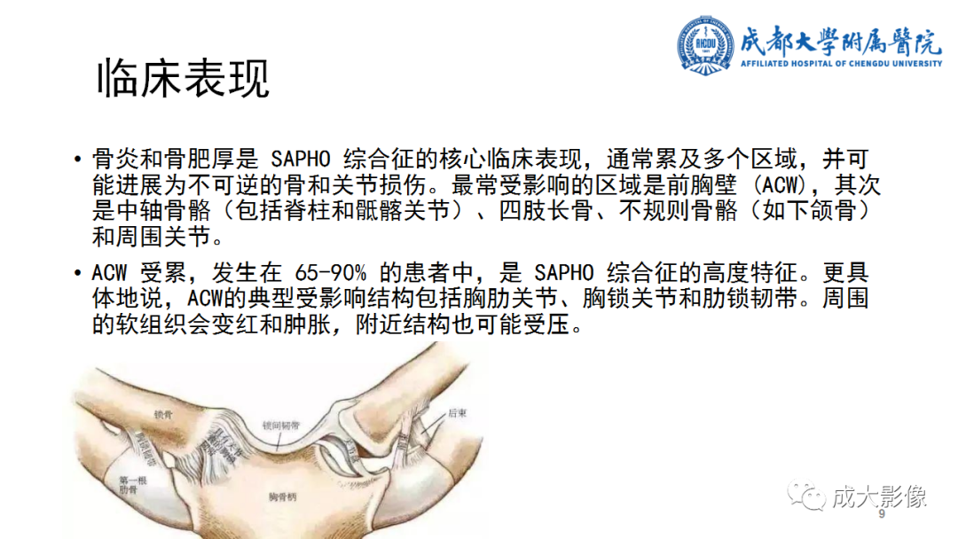 影像PPT - 【PPT】SAPHO综合征-9