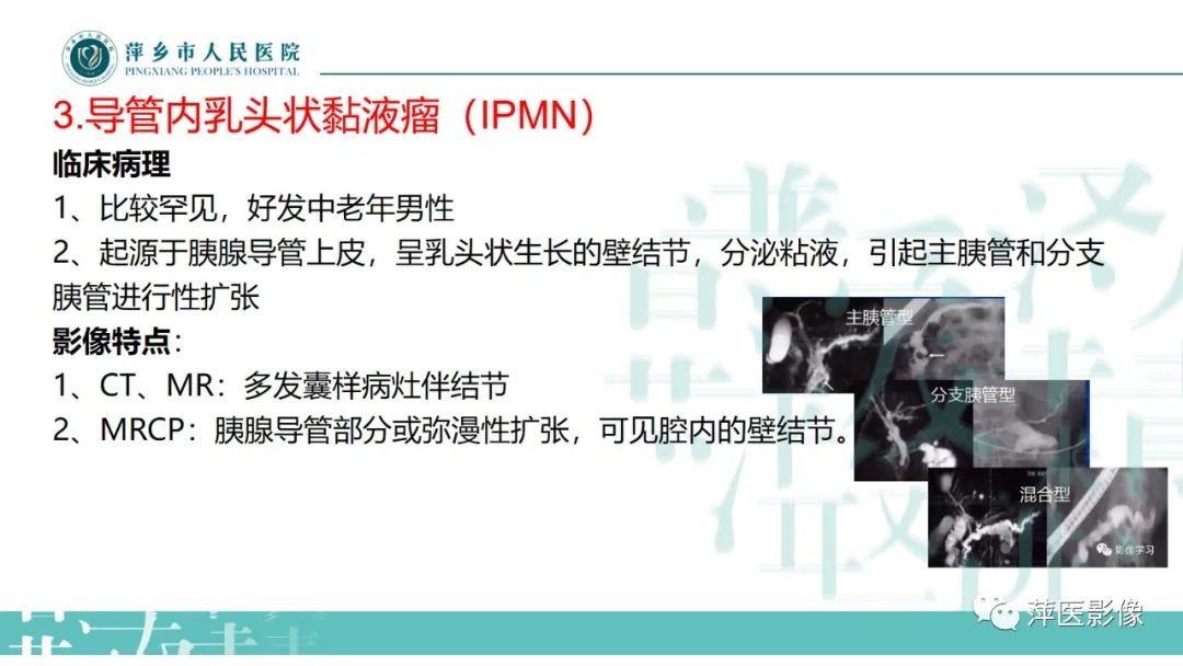 影像PPT - 【PPT】胰腺实性假乳头状瘤-23