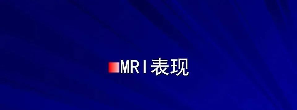 影像PPT - 【PPT】高血压脑血肿的CT、MRI表现及分期-20