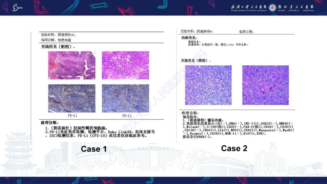 影像PPT - 【PPT】阴道髓系肉瘤影像诊断-6
