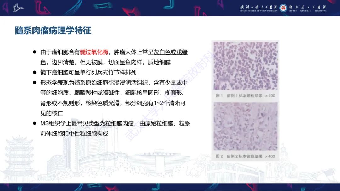 影像PPT - 【PPT】阴道髓系肉瘤影像诊断-12