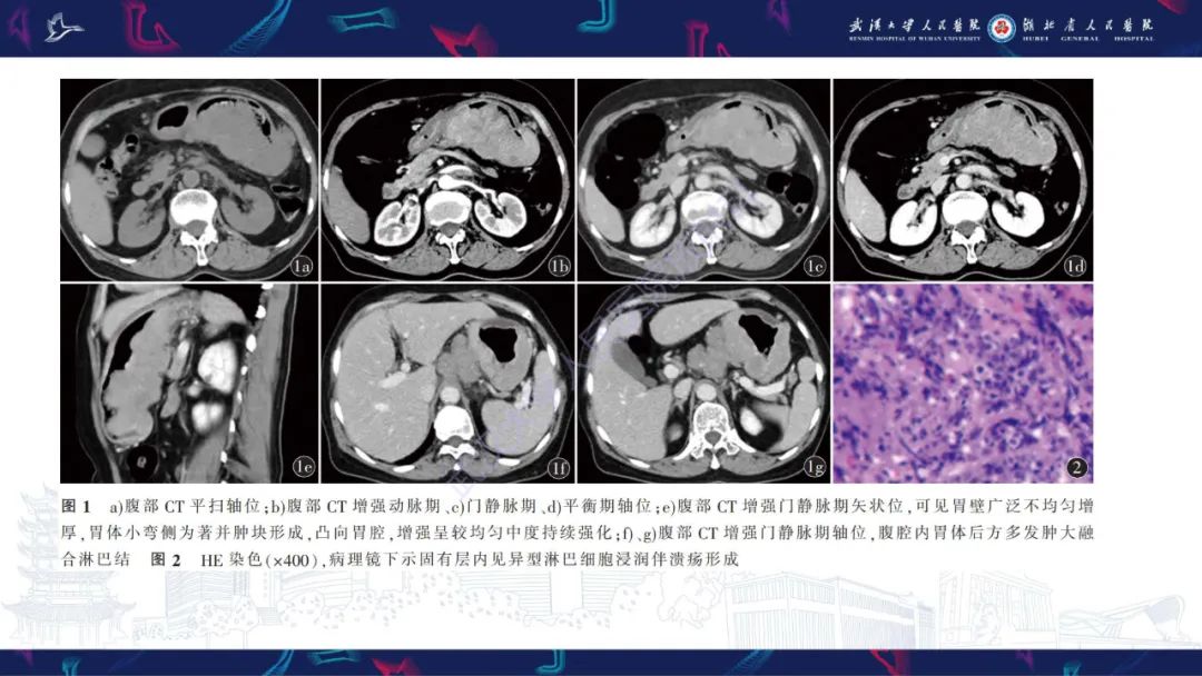 影像PPT - 【PPT】阴道髓系肉瘤影像诊断-18
