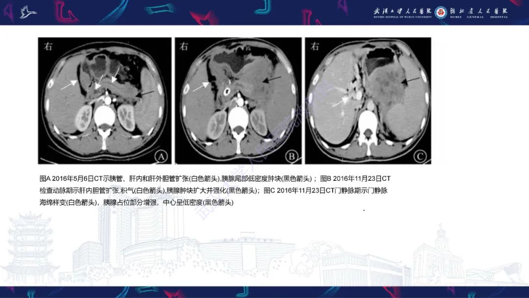 影像PPT - 【PPT】阴道髓系肉瘤影像诊断-19