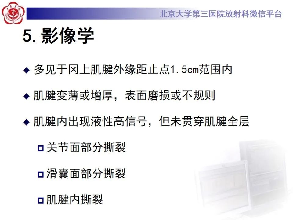 影像PPT - 【PPT】肩袖部分撕裂-13