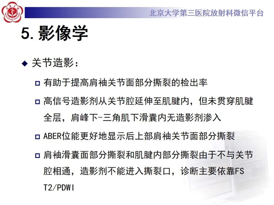 影像PPT - 【PPT】肩袖部分撕裂-15