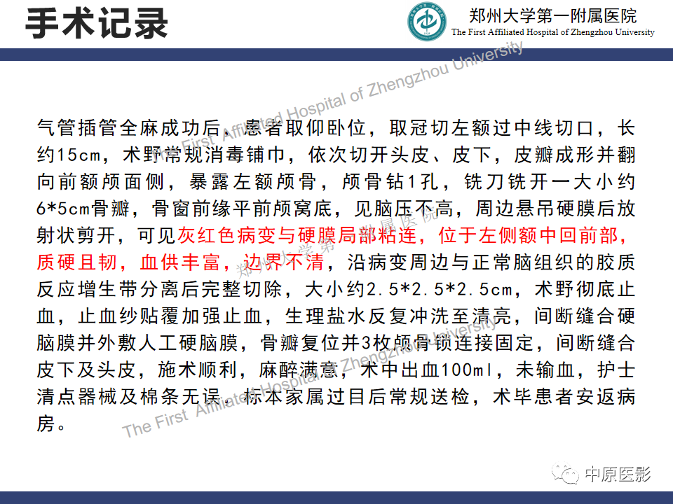 影像PPT - 【病例】神经梅毒1例MR影像-11