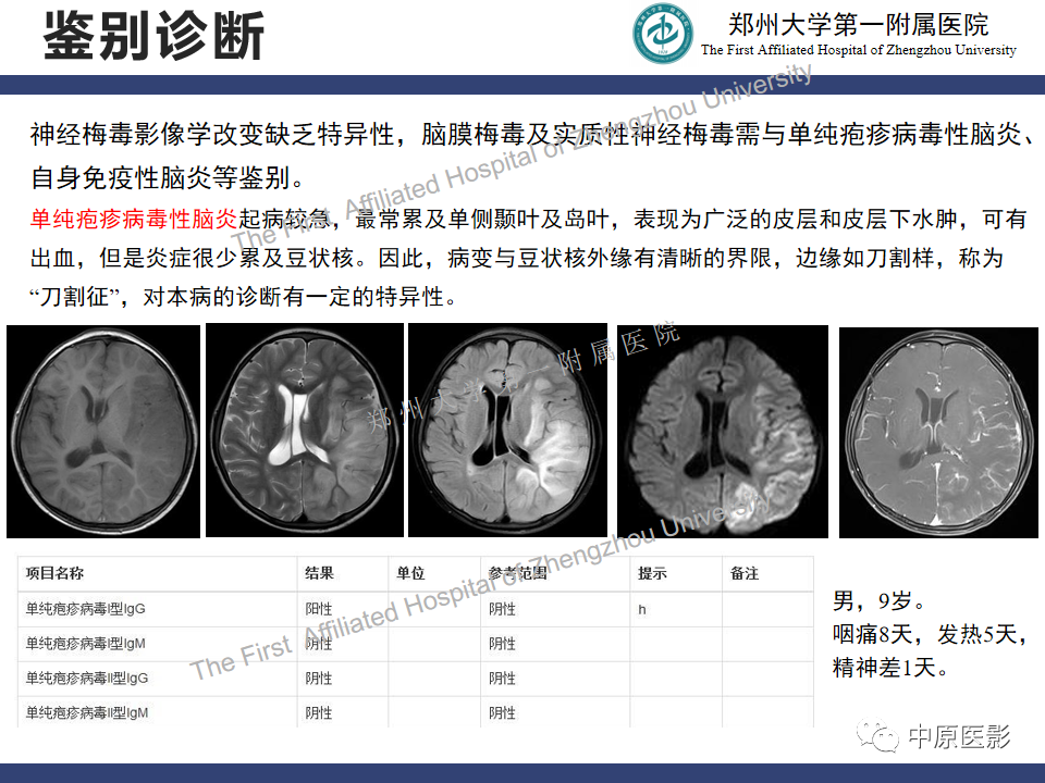影像PPT - 【病例】神经梅毒1例MR影像-26