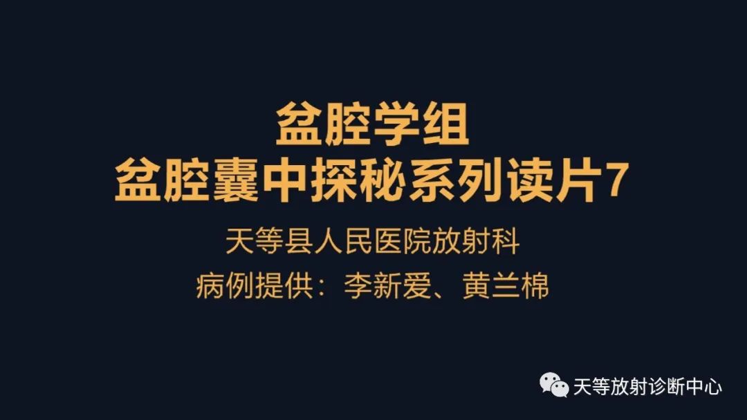 影像PPT - 【病例】中肾管囊肿/卵巢冠囊肿1例MR影像-2 影像PPT - 【病例】中肾管囊肿/卵巢冠囊肿1例MR影像-2