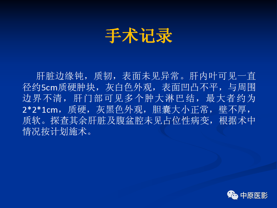 影像PPT - 【病例】肝脏胆管细胞癌1例MR影像-13