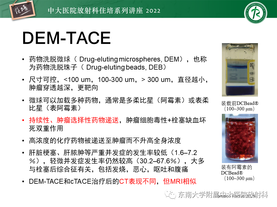 影像PPT - 【PPT】肝癌介入治疗后的磁共振评估-4