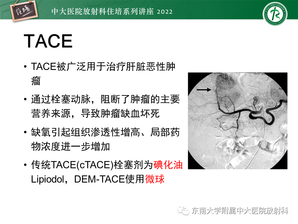 影像PPT - 【PPT】肝癌介入治疗后的磁共振评估-3