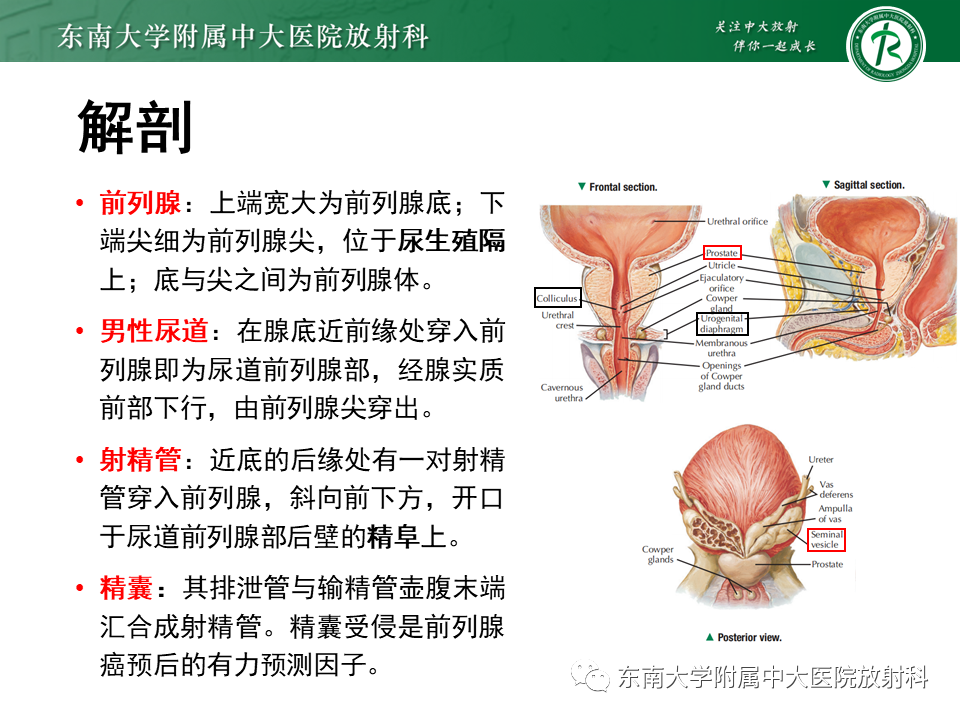 影像PPT - 【PPT】前列腺癌-9 影像PPT - 【PPT】前列腺癌-9