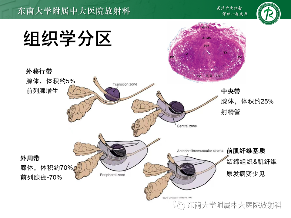 影像PPT - 【PPT】前列腺癌-10 影像PPT - 【PPT】前列腺癌-10