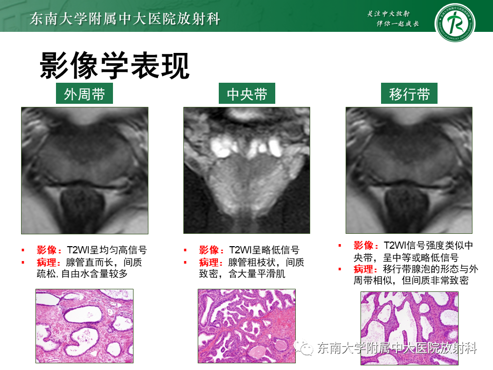 影像PPT - 【PPT】前列腺癌-12 影像PPT - 【PPT】前列腺癌-12