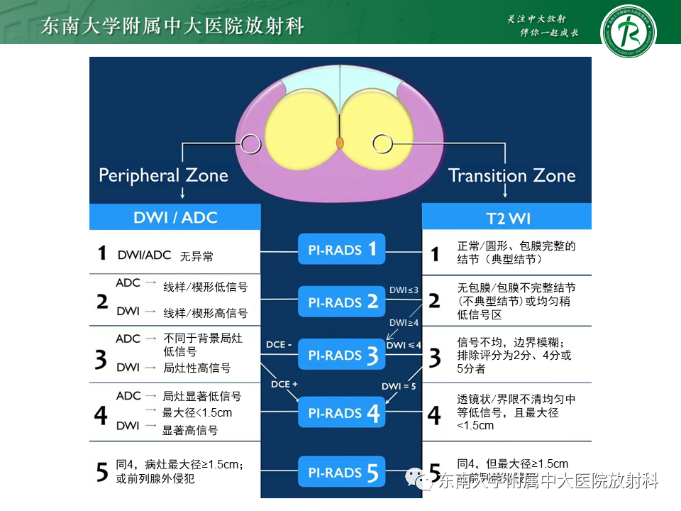影像PPT - 【PPT】前列腺癌-15 影像PPT - 【PPT】前列腺癌-15