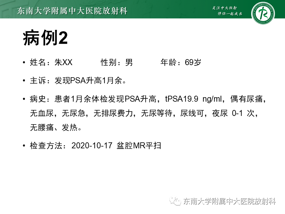影像PPT - 【PPT】前列腺癌-17 影像PPT - 【PPT】前列腺癌-17