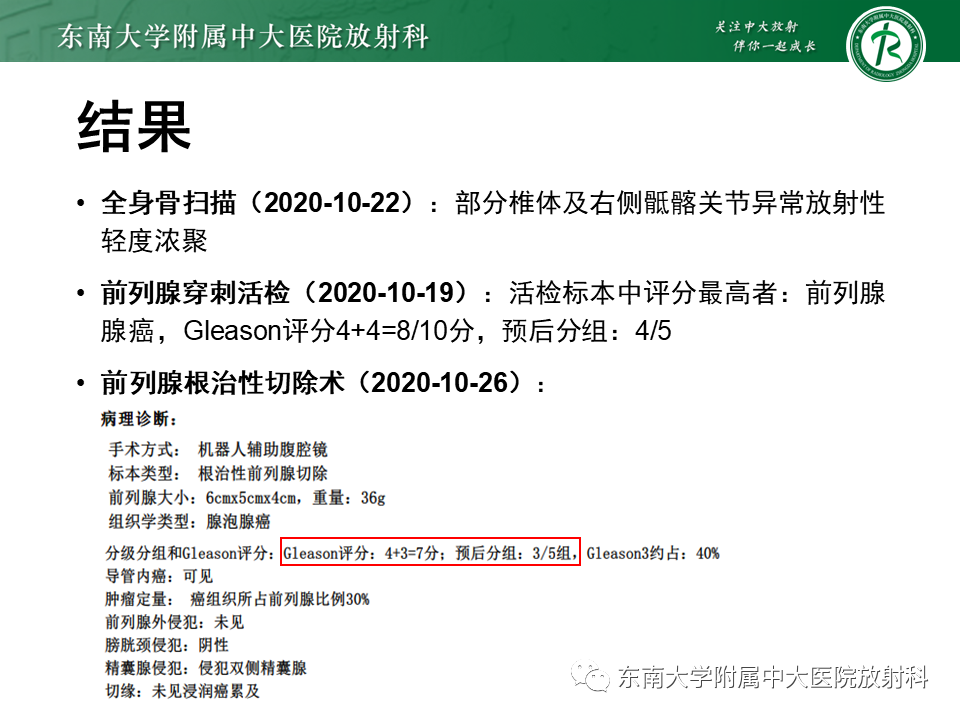 影像PPT - 【PPT】前列腺癌-20 影像PPT - 【PPT】前列腺癌-20