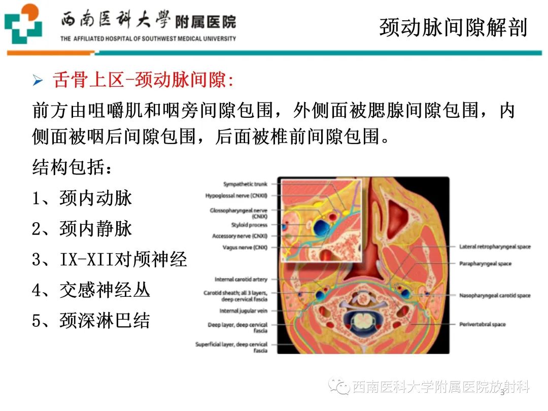影像PPT - 【PPT】颈动脉间隙常见病变的影像诊断-3