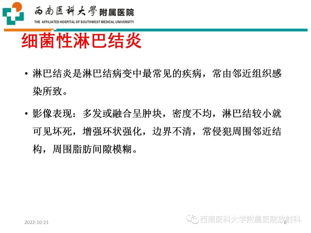 影像PPT - 【PPT】颈动脉间隙常见病变的影像诊断-8