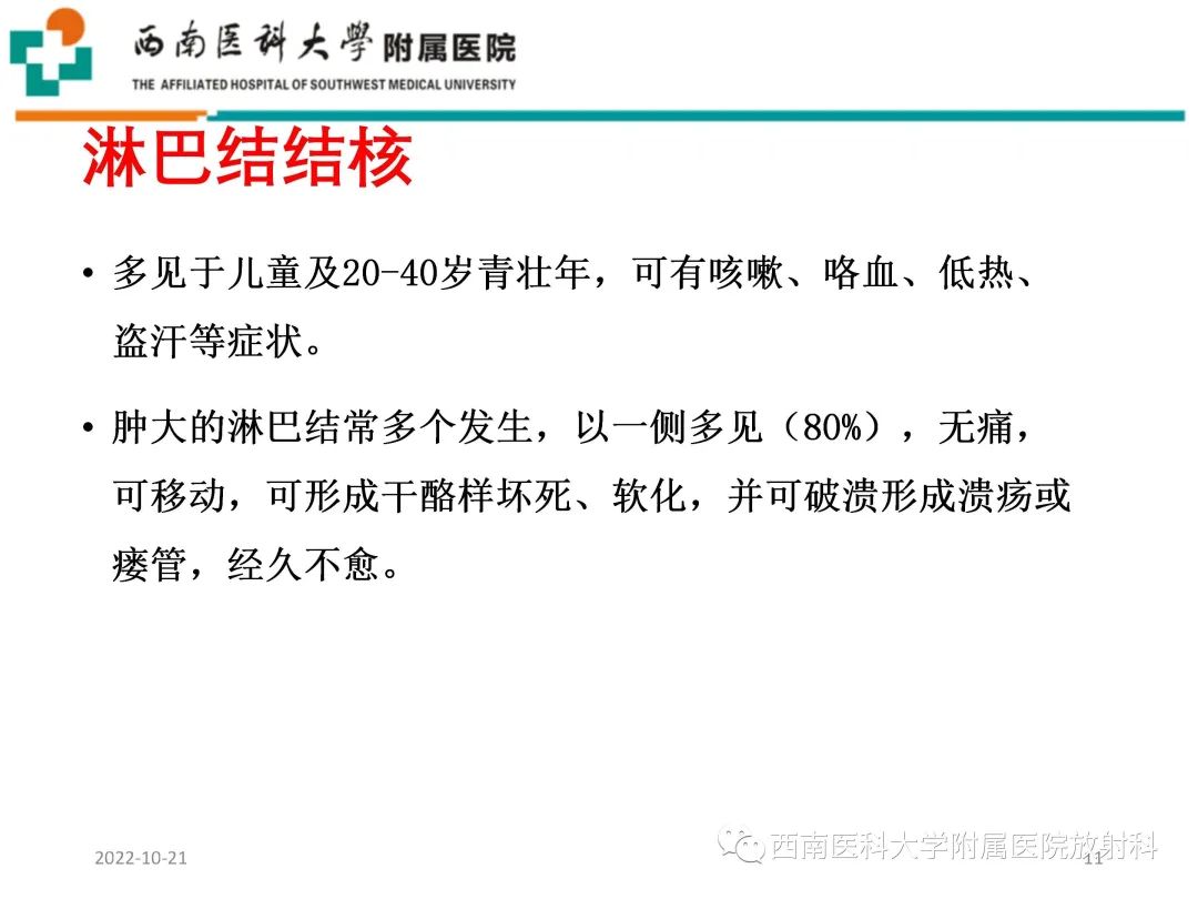 影像PPT - 【PPT】颈动脉间隙常见病变的影像诊断-11
