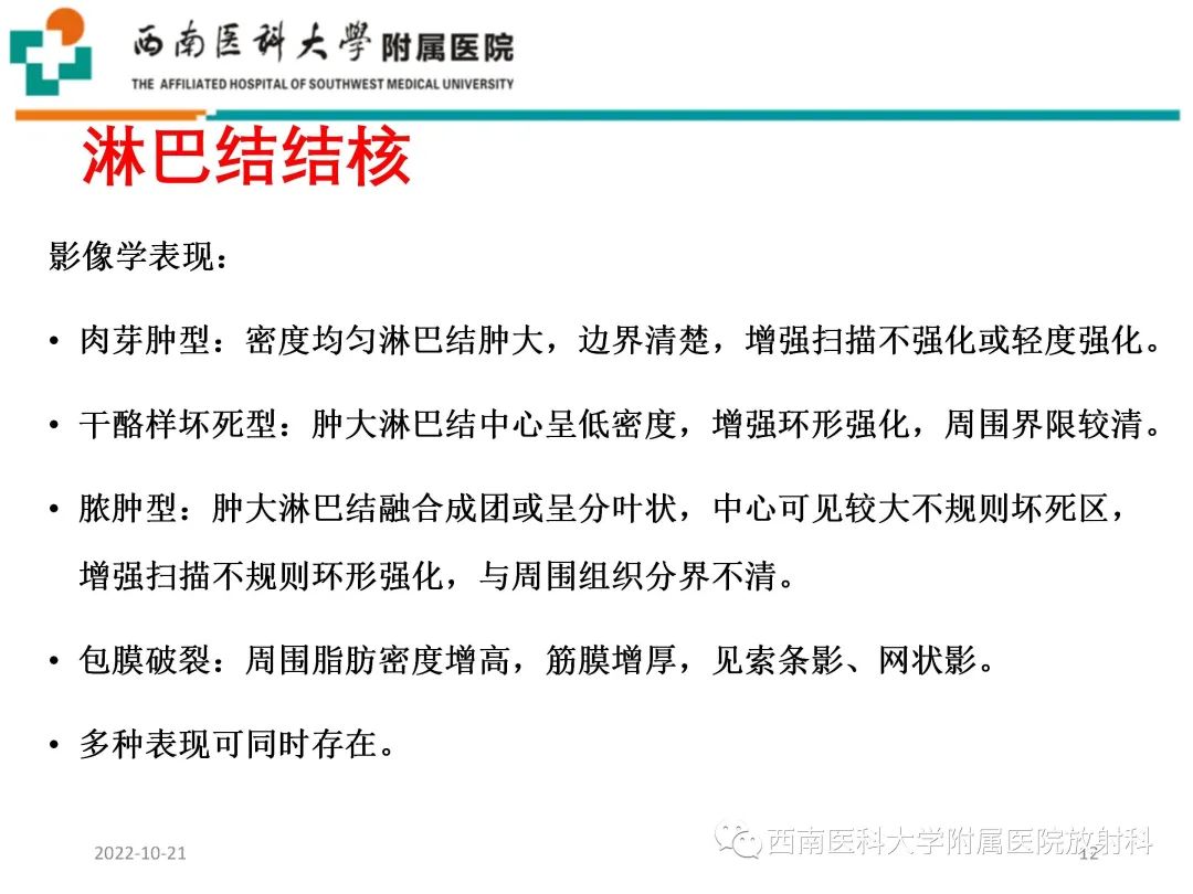 影像PPT - 【PPT】颈动脉间隙常见病变的影像诊断-12