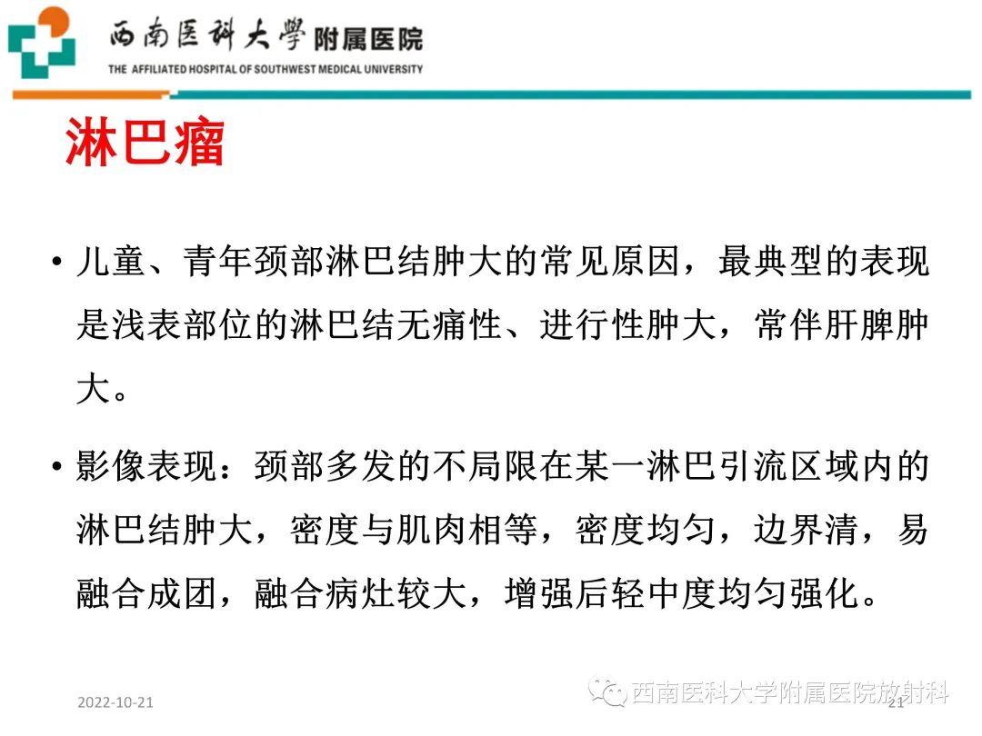 影像PPT - 【PPT】颈动脉间隙常见病变的影像诊断-21