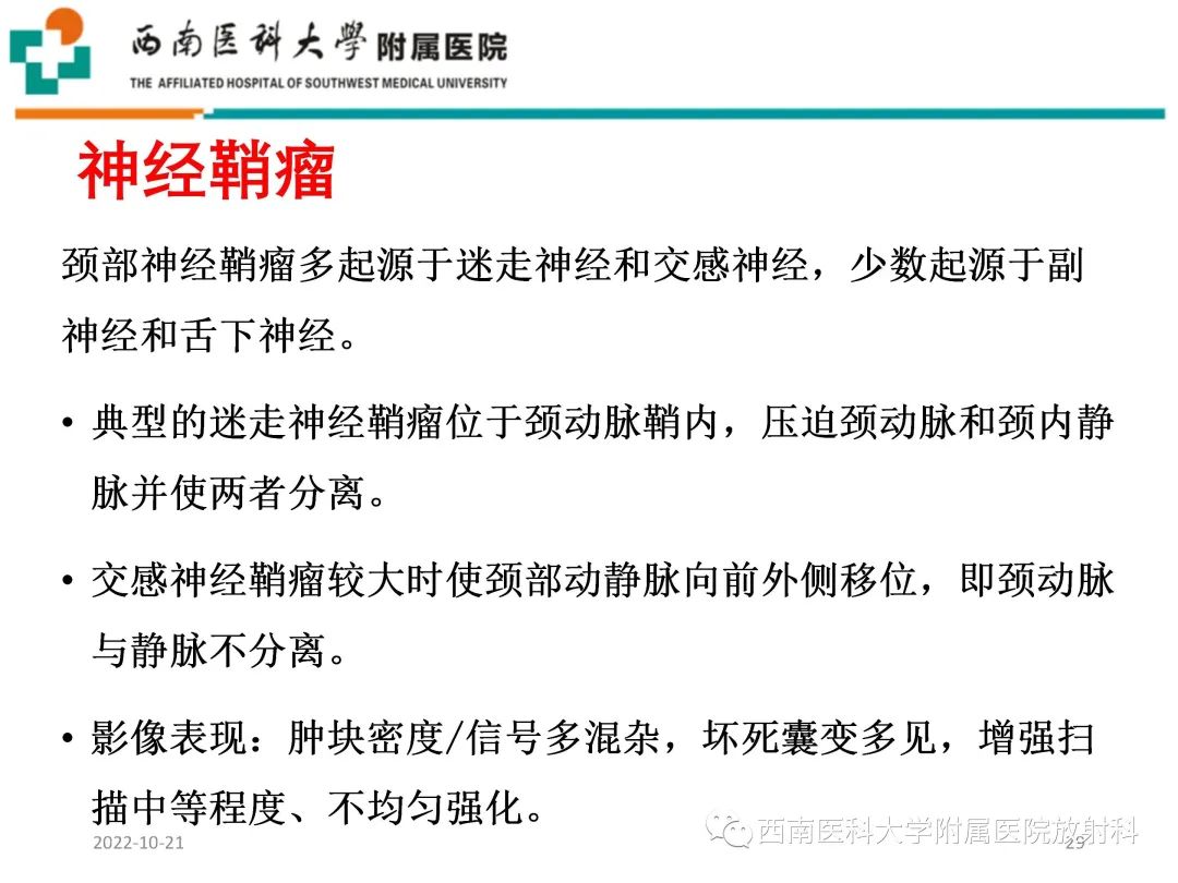影像PPT - 【PPT】颈动脉间隙常见病变的影像诊断-29