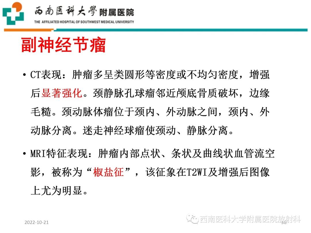影像PPT - 【PPT】颈动脉间隙常见病变的影像诊断-36