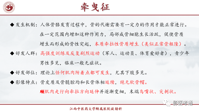影像PPT - 【PPT】骨软骨瘤影像诊断与鉴别-18 影像PPT - 【PPT】骨软骨瘤影像诊断与鉴别-18