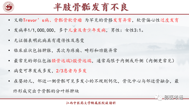 影像PPT - 【PPT】骨软骨瘤影像诊断与鉴别-23 影像PPT - 【PPT】骨软骨瘤影像诊断与鉴别-23