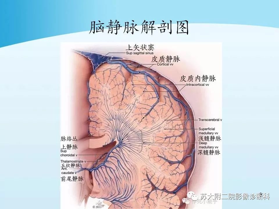 影像PPT - 【PPT】脑静脉血栓影像征象分析-8