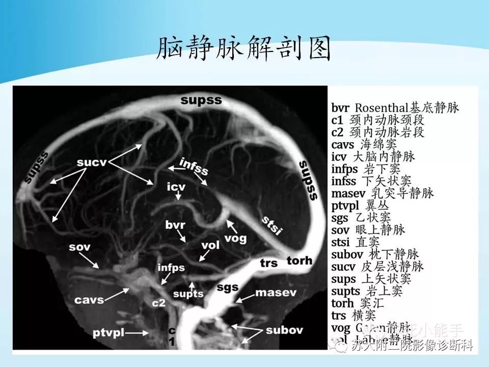 影像PPT - 【PPT】脑静脉血栓影像征象分析-9
