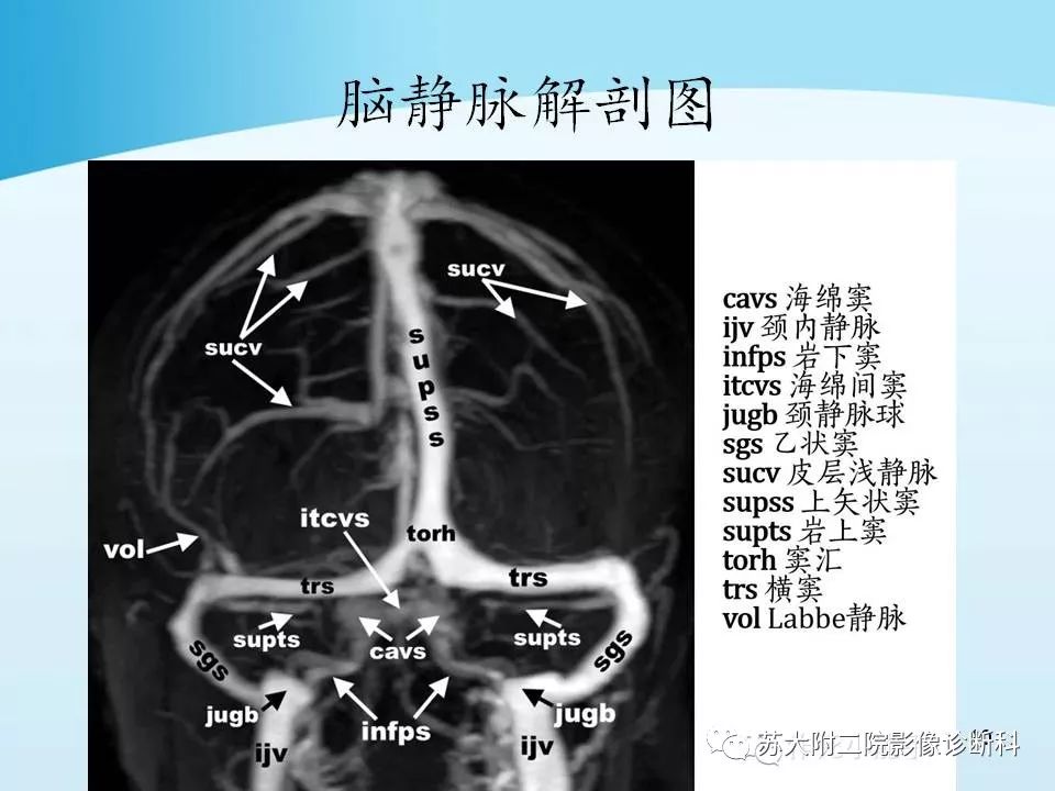 影像PPT - 【PPT】脑静脉血栓影像征象分析-10